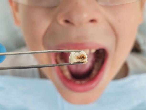 Best Emergency Dental Services for Seniors in Sewaren, NJ